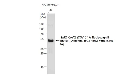 SARS-CoV-2 (COVID-19) Nucleocapsid protein, Omicron / BA.2 / BA.5 variant, His tag. GTX137219-pro