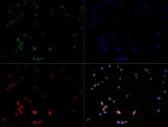 Anti-TLR7 antibody used in Immunocytochemistry/ Immunofluorescence (ICC/IF). GTX13730