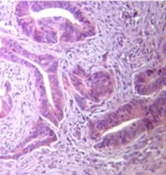 Anti-TLR5 antibody used in IHC (Paraffin sections) (IHC-P). GTX13868