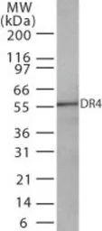 Anti-DR4 antibody [32A242] used in Western Blot (WB). GTX13890