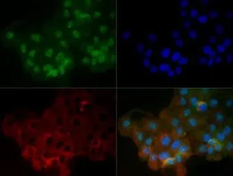 Anti-Lamin A + C antibody used in Immunocytochemistry/ Immunofluorescence (ICC/IF). GTX13910