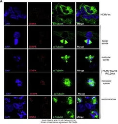 Anti-CENPA antibody [3-19] used in Immunocytochemistry/ Immunofluorescence (ICC/IF). GTX13939