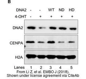 Anti-CENPA antibody [3-19] used in Western Blot (WB). GTX13939
