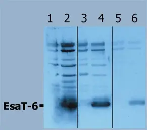 Anti-Mycobacterium tuberculosis ESAT6 antibody used in Western Blot (WB). GTX13960