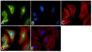 Anti-PLK1 antibody [Mixed clones] used in Immunocytochemistry/ Immunofluorescence (ICC/IF). GTX14210