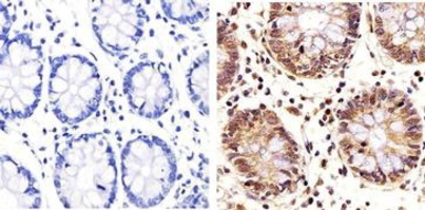 Anti-PLK1 antibody [Mixed clones] used in IHC (Paraffin sections) (IHC-P). GTX14210