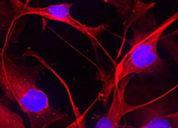 Anti-A2B5 antibody [105] used in Immunocytochemistry/ Immunofluorescence (ICC/IF). GTX14538