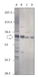 Anti-Punt antibody used in Western Blot (WB). GTX14680