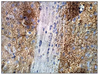 Anti-Adenylate cyclase 2 antibody used in IHC (Paraffin sections) (IHC-P). GTX14777