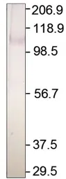 Anti-Adenylate cyclase 2 antibody used in Western Blot (WB). GTX14777