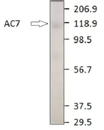 Anti-ADCY7 antibody used in Western Blot (WB). GTX14782