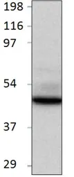 Anti-BMP2 antibody used in Western Blot (WB). GTX14933