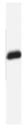 Anti-BCAP31 antibody [CC-1] used in Western Blot (WB). GTX15044