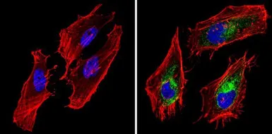 Anti-BCAP31 antibody [CC-1] used in Immunocytochemistry/ Immunofluorescence (ICC/IF). GTX15044