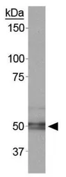Anti-Carbonic Anhydrase IX antibody used in Western Blot (WB). GTX15086