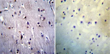 Anti-Presenilin 1 antibody [APS 11] used in IHC (Paraffin sections) (IHC-P). GTX15456