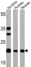 Anti-Presenilin 1 antibody [APS 11] used in Western Blot (WB). GTX15456
