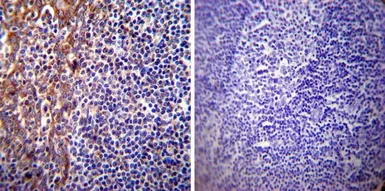 Anti-Presenilin 1 antibody [APS 18] used in IHC (Paraffin sections) (IHC-P). GTX15458