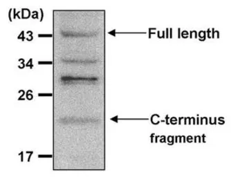 Anti-Presenilin 1 antibody [APS 18] used in Western Blot (WB). GTX15458