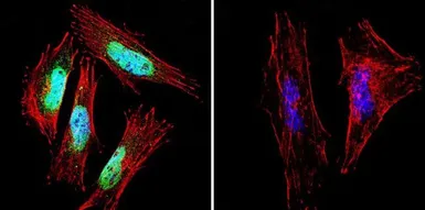 Anti-Presenilin 1 antibody [APS 18] used in Immunocytochemistry/ Immunofluorescence (ICC/IF). GTX15458