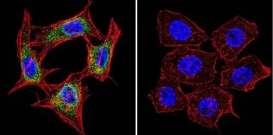 Anti-Presenilin 1 antibody [APS 18] used in Immunocytochemistry/ Immunofluorescence (ICC/IF). GTX15458