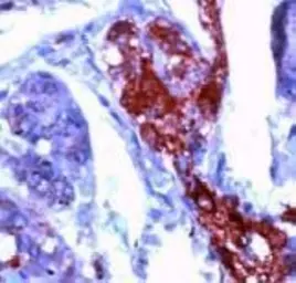 Anti-NSE antibody (Ready-to-use) used in IHC (Paraffin sections) (IHC-P). GTX15488