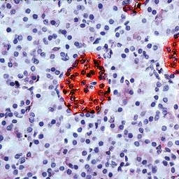 Anti-NSE antibody (Ready-to-use) used in IHC (Paraffin sections) (IHC-P). GTX15488