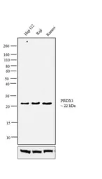 Anti-PRX I antibody used in Western Blot (WB). GTX15571
