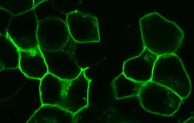 Anti-GPR20 antibody used in Immunocytochemistry/ Immunofluorescence (ICC/IF). GTX15609