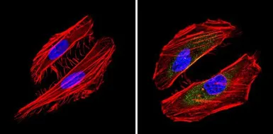 Anti-Bid antibody [23F7] used in Immunocytochemistry/ Immunofluorescence (ICC/IF). GTX15667