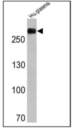 Anti-Fibronectin antibody [3F12] used in Western Blot (WB). GTX15737