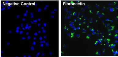 Anti-Fibronectin antibody [3F12] used in Immunocytochemistry/ Immunofluorescence (ICC/IF). GTX15737