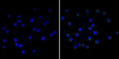 Anti-CD18 antibody [TS1/18] used in Immunocytochemistry/ Immunofluorescence (ICC/IF). GTX15770