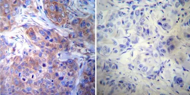 Anti-gamma Tubulin antibody [4D11] used in IHC (Paraffin sections) (IHC-P). GTX15794
