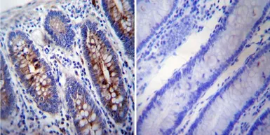 Anti-gamma Tubulin antibody [4D11] used in IHC (Paraffin sections) (IHC-P). GTX15794