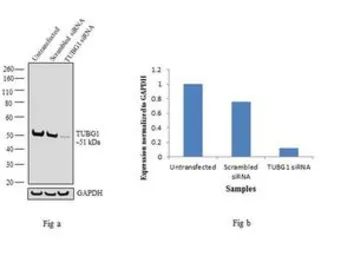 Anti-gamma Tubulin antibody [4D11] used in Western Blot (WB). GTX15794