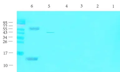 Anti-CGRP antibody used in Western Blot (WB). GTX16211