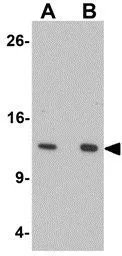 Anti-HIGD1A antibody used in Western Blot (WB). GTX16279