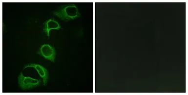 Anti-ALK (phospho Tyr1604) antibody used in Immunocytochemistry/ Immunofluorescence (ICC/IF). GTX16377