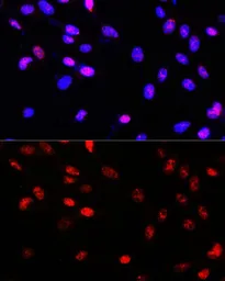 Anti-TCF4 antibody used in Immunocytochemistry/ Immunofluorescence (ICC/IF). GTX16385