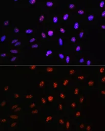 Anti-TCF4 antibody used in Immunocytochemistry/ Immunofluorescence (ICC/IF). GTX16385
