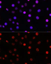 Anti-TCF4 antibody used in Immunocytochemistry/ Immunofluorescence (ICC/IF). GTX16385