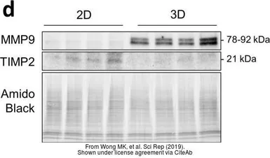 Anti-TIMP2 antibody used in Western Blot (WB). GTX16392