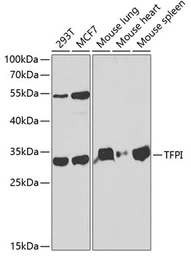 Anti-TFPI antibody used in Western Blot (WB). GTX16395
