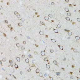 Anti-UBE2D1 antibody used in IHC (Paraffin sections) (IHC-P). GTX16400