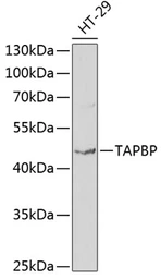 Anti-Tapasin antibody used in Western Blot (WB). GTX16401