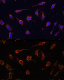 Anti-Tollip antibody used in Immunocytochemistry/ Immunofluorescence (ICC/IF). GTX16406