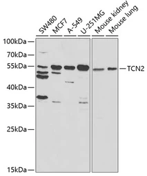 Anti-Transcobalamin 2 antibody used in Western Blot (WB). GTX16437
