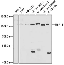 Anti-USP16 antibody used in Western Blot (WB). GTX16439
