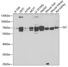 Anti-Transketolase antibody used in Western Blot (WB). GTX16442